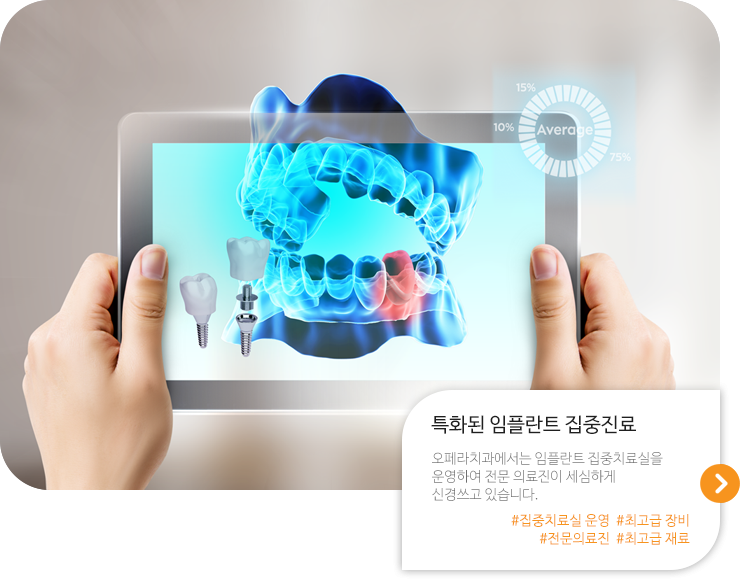 임플란트 집중진료
