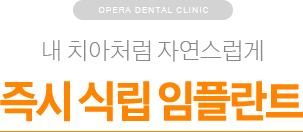 내 치아처럼 자연스럽게 / 즉시 식립 임플란트