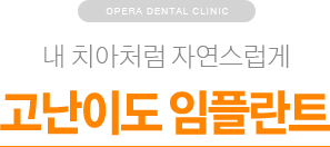 내 치아처럼 자연스럽게 / 고난이도 임플란트