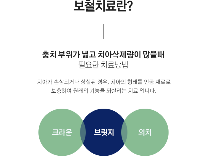 보철치료란?
충치 부위가 넓고 치아삭제량이 많을때 필요한 치료방법
치아가 손상되거나 상실된 경우, 치아의 형태를 인공 재료로 보충하여 원래의 기능을 되살리는 치료 입니다.