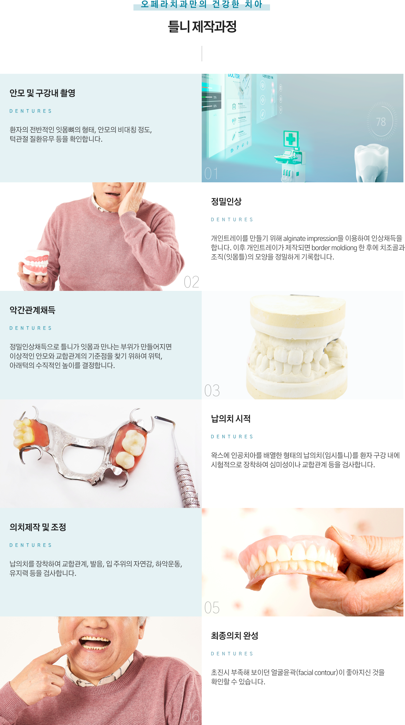 틀니 제작과정
안모 및 구강내 촬영 : 환자의 전반적인 잇몸뼈의 형태, 안모의 비대칭 정도, 턱관절 질환유무 등을 확인합니다.
정밀인상 : 개인트레이를 만들기 위해 alginate impression을 이용하여 인상채득을 합니다.
이후 개인트레이가 제작되면 border moldiong 한 후에 치조골과 조직(잇몸틀)의 모양을 정밀하게 기록합니다.
악간관계채득 : 정밀인상채득으로 틀니가 잇몸과 만나는 부위가 만들어지면 이상적인 안모와 교합관계의 기준점을 찾기 위하여 위턱, 아래턱의 수직적인 높이를 결정합니다.
납의치 시적 : 왁스에 인공치아를 배열한 형태의 납의치(임시틀니)를 환자 구강 내에 시험적으로 장착하여 심미성이나 교합관계 등을 검사합니다.
의치제작 및 조정 : 납의치를 장착하여 교합관계, 발음, 입 주위의 자연감, 하악운동, 유지력 등을 검사합니다.
최종의치 완성 : 초진시 부족해 보이던 얼굴윤곽(facial contour)이 좋아지신 것을 확인할 수 있습니다.